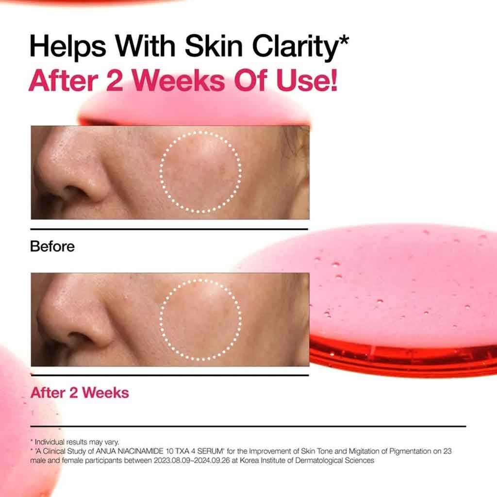 Anua NIACINAMIDE 10%+TXA 4% Serum