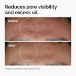 The Ordinary Niacinamide 10% + Zinc 1% - 30ml - Image 3